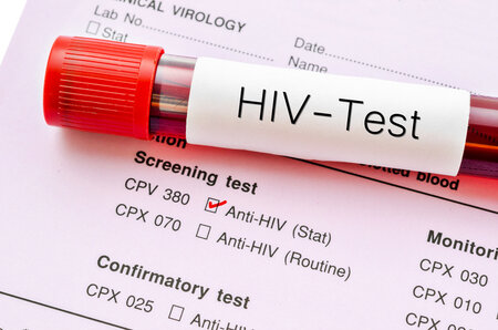 HIV-Test